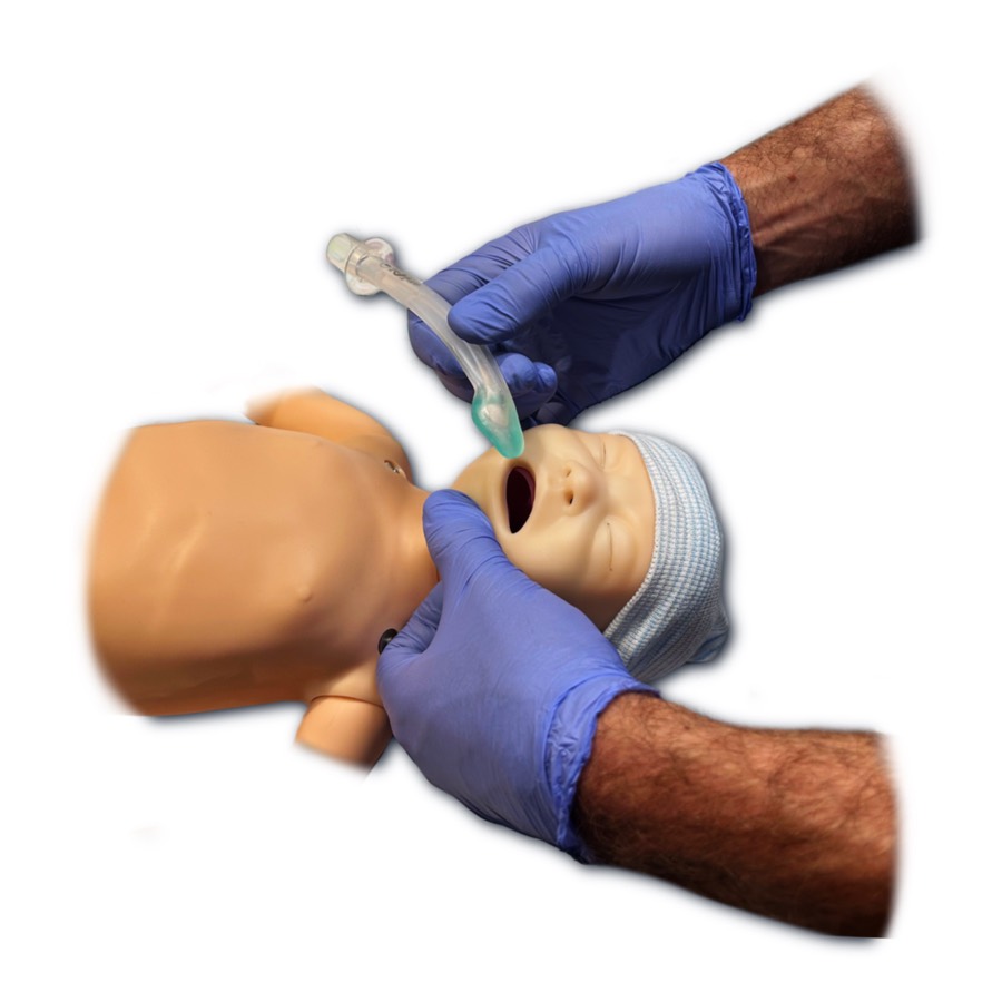 Illustration of an i-gel supraglottic airway being inserted
